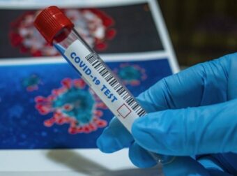Νέα τιμή από σήμερα στα μοριακά τεστ (PCR) – «Θα είναι κοντά στα 50 ευρώ» (Video) – Ελλάδα