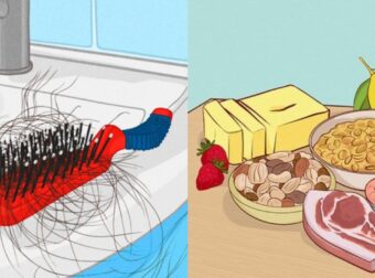 Πυκνά και υγιή μαλλιά: Τροφές και βιταμίνες για μείωση της τριχόπτωσης με φυσικό τρόπο