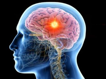 Το αντικαρκινικό λαχανικό που δυναμώνει εγκέφαλο και όραση και οι περισσότεροι δεν το αγαπάμε – Ομορφιά & Υγεία