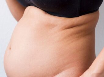 Λίπος στη κοιλιά! 5 ενδείξεις που δείχνουν ότι  οφείλεται σε ορμονική ανισορροπία – Ομορφιά & Υγεία