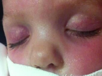 Αυτή η φωτογραφία του μωρού κρύβει ένα θανάσιμο κίνδυνο – Δυστυχώς λίγες μέρες μετά… – Viral