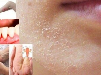 Όταν το σώμα ζητά βοήθεια: 10 σημαντικά σημάδια που δεν μπορείτε να αγνοήσετε! – Ομορφιά & Υγεία