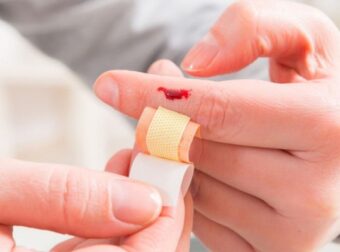 Αυτό είναι το μπαχαρικό που μπορεί να σταματήσετε την αιμορραγία – Ομορφιά & Υγεία