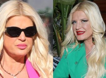 Μαρίνα Πατούλη: Αγνώριστη πριν την πλαστική επέμβαση στο πρόσωπό της