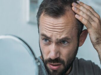 Αυτές είναι οι αιτίες που οι άνδρες χάνουν τα μαλλιά τους – Πότε θεωρείται μη φυσιολογικό – Ομορφιά & Υγεία
