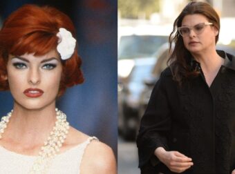 «Δεν με αναγνωρίζω πλέον!»: Σε άσχημη κατάσταση η Λίντα Εβαντζελίστα, παραμορφώθηκε από τις πλαστικές