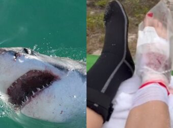 Καρχαρίας δάγκωσε γυναίκα στο πόδι – Δεν φαντάζεστε τι έκανε για να σωθεί (video) – Funny-Περίεργα