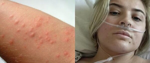 Γυναίκα είχε έντονη φαγούρα για μήνες – Αυτό που ανακάλυψε την σόκαρε (video) – Funny-Περίεργα