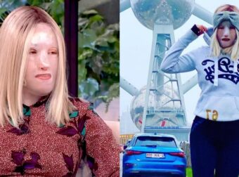 Ιωάννα Παλιοσπύρου: "Έχω την ανάγκη να μοιραστώ τη νέα μου εικόνα" – Η νέα φωτογραφία με το τραύμα