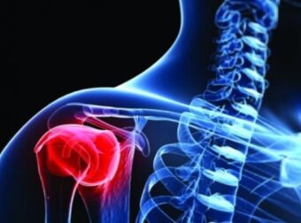 Καρκίνος στα οστά: Αυτά είναι τα ύπουλα συμπτώματα – Οι εξετάσεις που τον εντοπίζουν – Ομορφιά & Υγεία