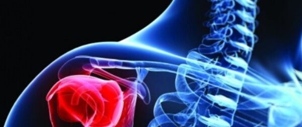 Καρκίνος στα οστά: Αυτά είναι τα ύπουλα συμπτώματα – Οι εξετάσεις που τον εντοπίζουν – Ομορφιά & Υγεία