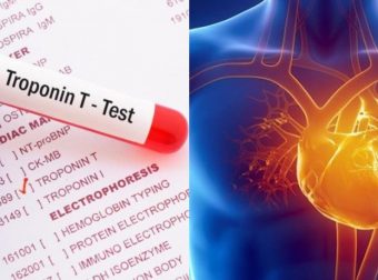 Πάτρα: Τι ακριβώς είναι η ουσία Τροπονίνη που λέγεται ότι βρέθηκε στα ύψη στην 9χρονη Τζωρτζίνα