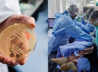 Candida Auris: Ο νέος εφιάλτης μετά τον κορωνοϊό – Ο θανατηφόρος μύκητας που δεν βγαίνει ποτέ από τα νοσοκομεία